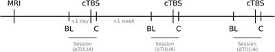 Improved gesturing in left-hemispheric stroke by right inferior parietal theta burst stimulation